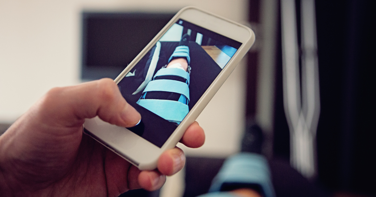 When Can I Hike After ACL Surgery A Comprehensive Guide